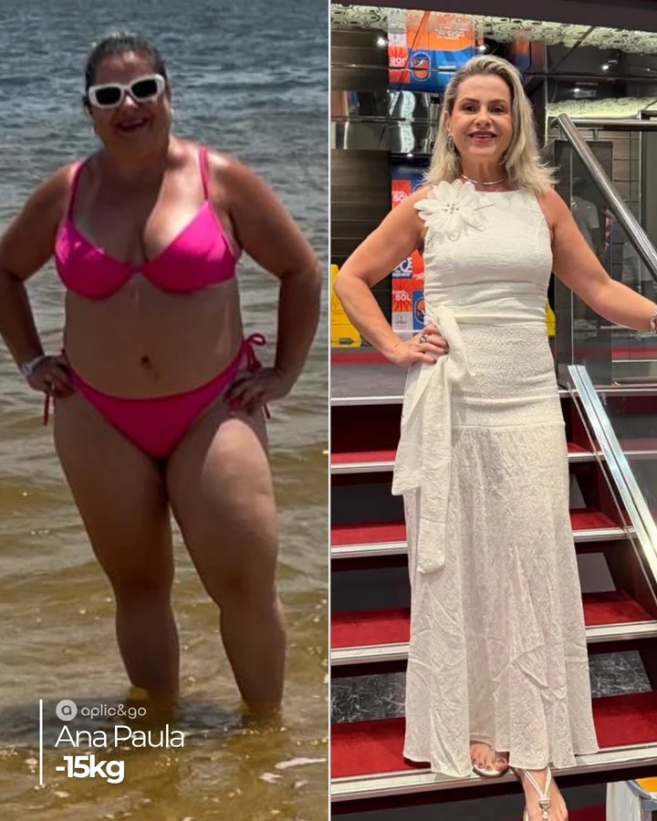 Comparação de fotos — Ana Paula